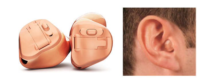 In-The-Canal hearing aid