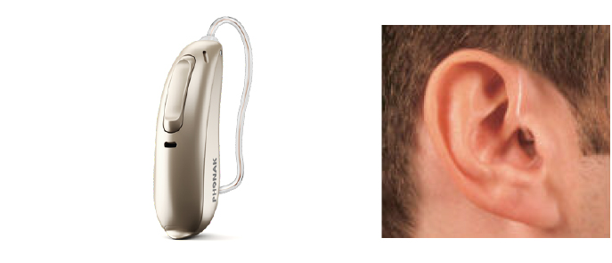 Open-Fit hearing aid