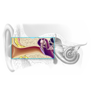 Conductive hearing loss anatomy diagram